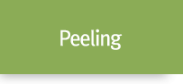 Peeling